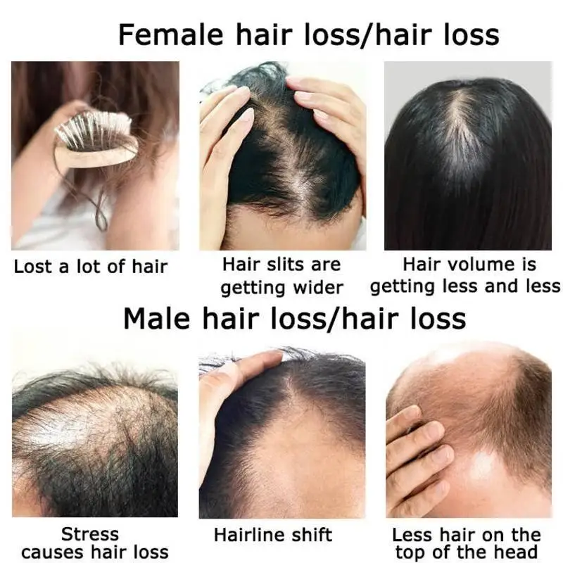 Olejek eteryczny na porost wło – Hair Care Herbal Products recenzja i cena