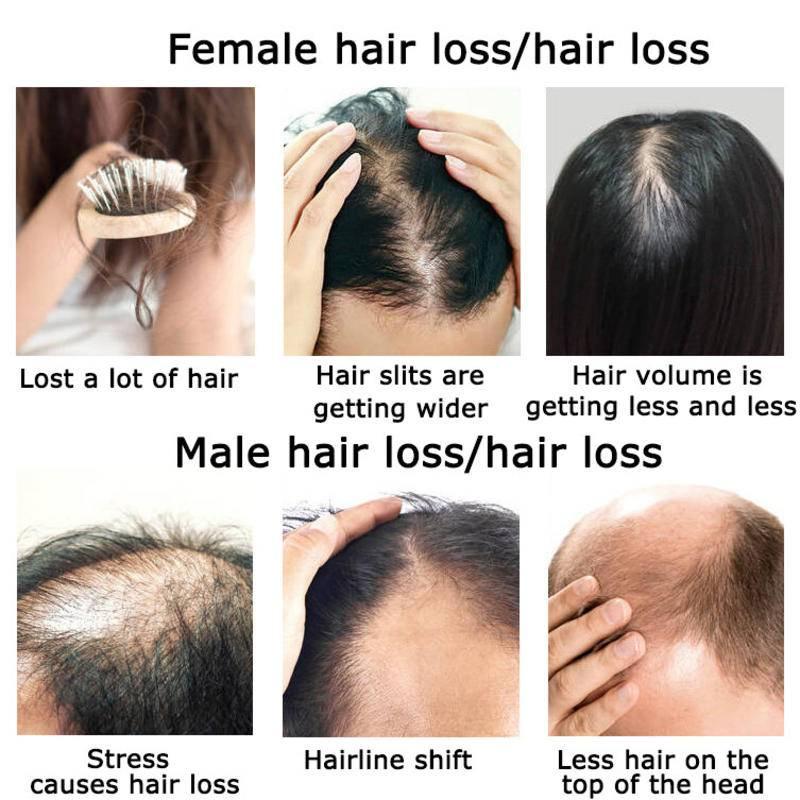 Olejek eteryczny na porost wło – Hair Care Herbal Products recenzja i cena