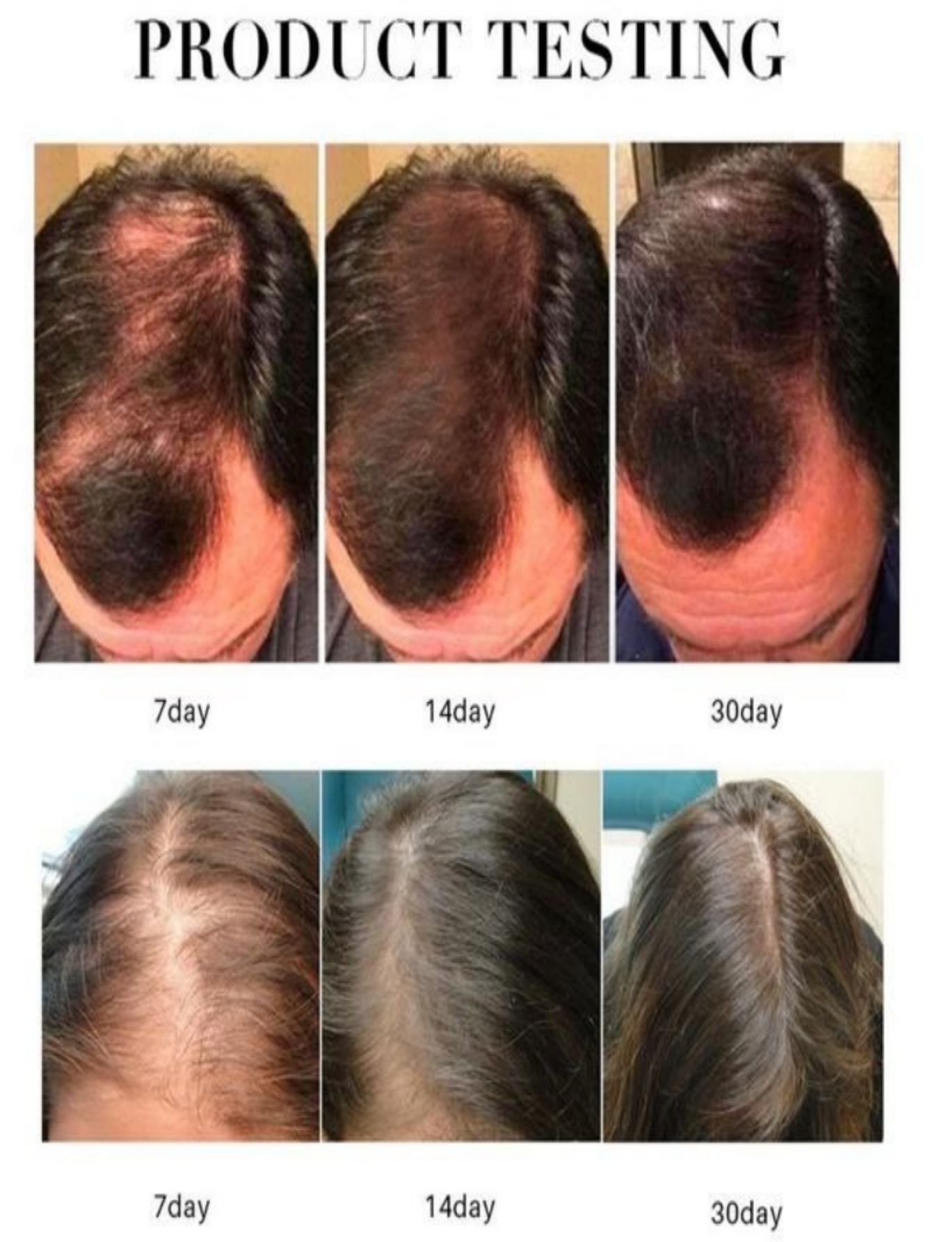 Olejek na porost włosów w spra – Hair Care Herbal Products recenzja i cena