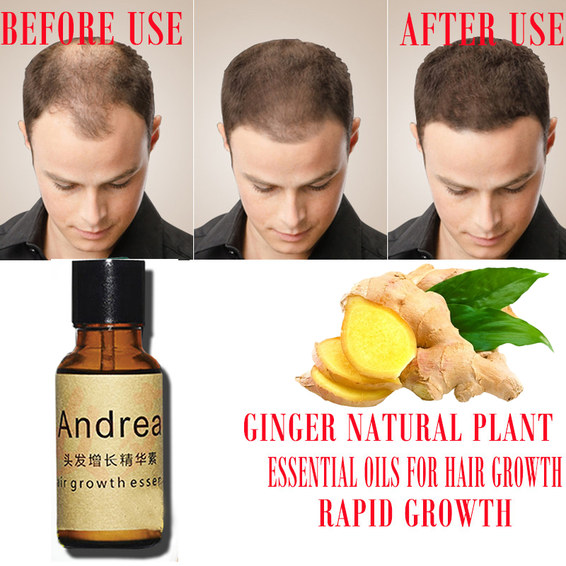 2/5/10Pcs Andrea Hair Growth S – Hair Care Herbal Products recenzja i cena