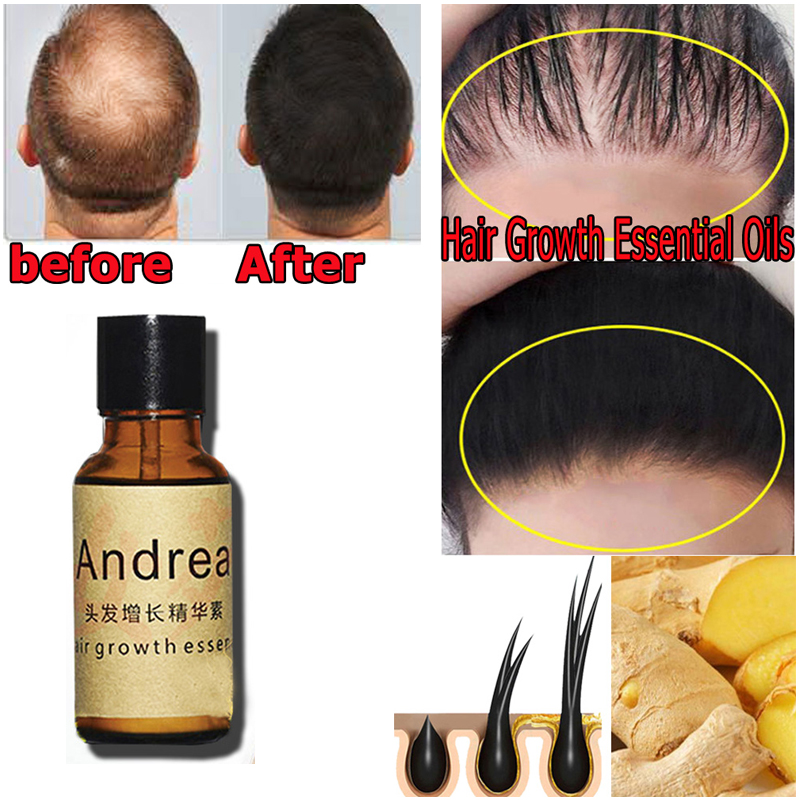 2/5/10Pcs Andrea Hair Growth S – Hair Care Herbal Products recenzja i cena